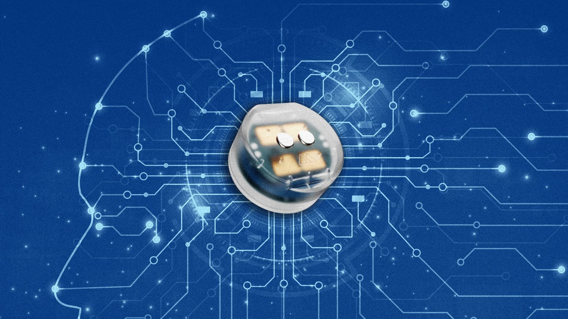 Brain Implant Breakthrough Opens New Mental Health Treatment Path